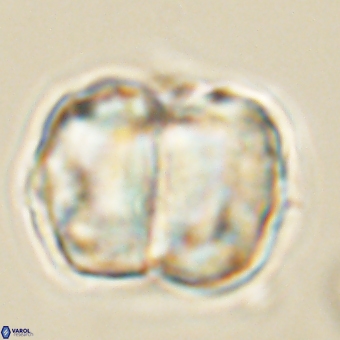 Micrantholithus disculus 67752