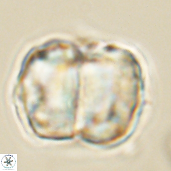 Micrantholithus disculus 67752