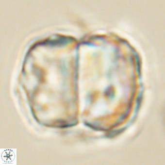 Micrantholithus disculus 67753