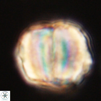 Micrantholithus disculus 67758