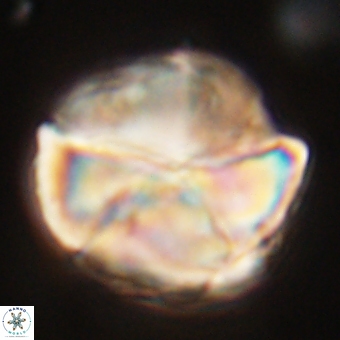 Micrantholithus disculus 67759