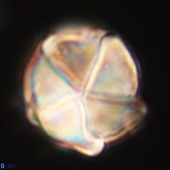 Micrantholithus disculus 67763