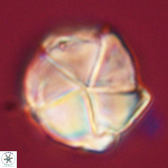 Micrantholithus disculus 67765