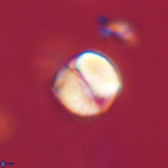 Micrantholithus disculus 67352