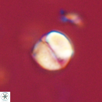 Micrantholithus disculus 67352