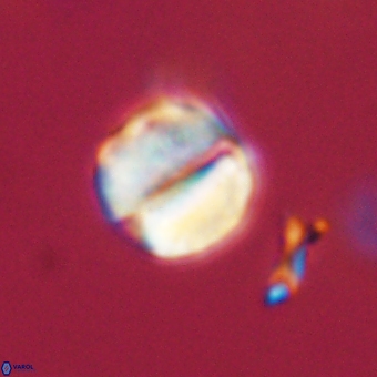 Micrantholithus disculus 67353