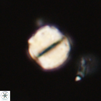 Micrantholithus disculus 67355