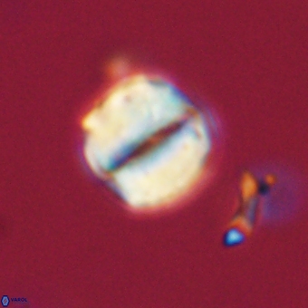 Micrantholithus disculus 67356