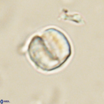 Micrantholithus disculus 67359