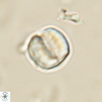 Micrantholithus disculus 67359
