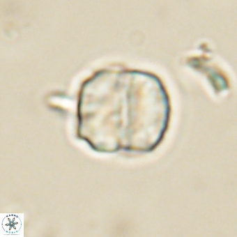 Micrantholithus disculus 67360