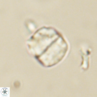 Micrantholithus disculus 67361