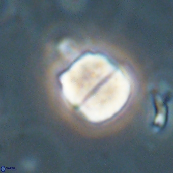 Micrantholithus disculus 67362