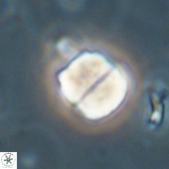 Micrantholithus disculus 67362