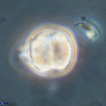 Micrantholithus disculus 67363