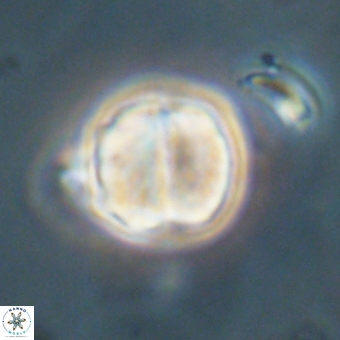Micrantholithus disculus 67363