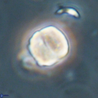 Micrantholithus disculus 67364