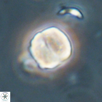 Micrantholithus disculus 67364