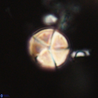 Micrantholithus disculus 67365