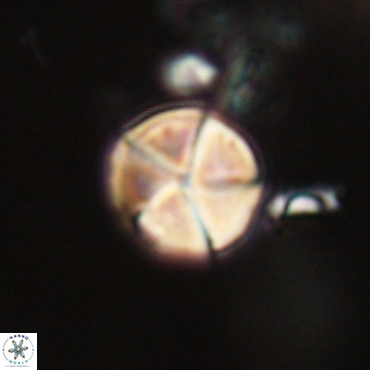 Micrantholithus disculus 67365