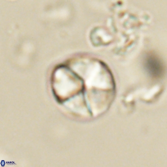 Micrantholithus disculus 67369