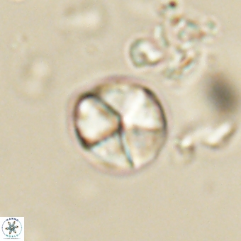 Micrantholithus disculus 67369