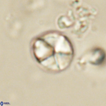 Micrantholithus disculus 67370
