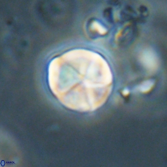 Micrantholithus disculus 67371