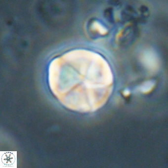Micrantholithus disculus 67371