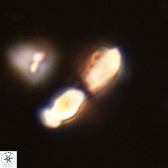 Micrantholithus imbricatus VR 02006