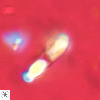 Micrantholithus imbricatus VR 02007