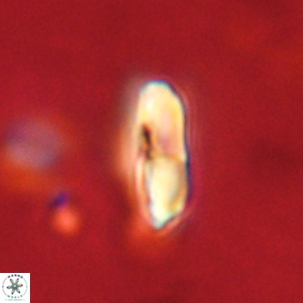Micrantholithus imbricatus VR 02010
