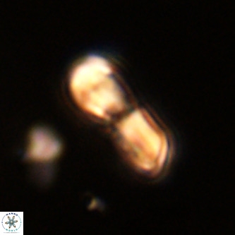 Micrantholithus imbricatus VR 02013