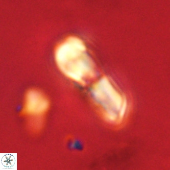 Micrantholithus imbricatus VR 02014