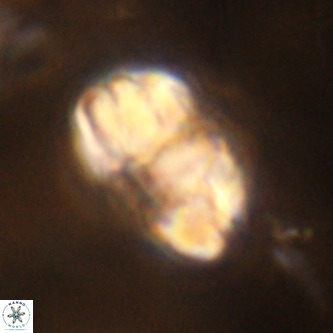 Micrantholithus imbricata VR 01245