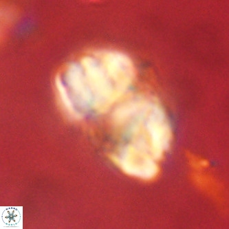 Micrantholithus imbricata VR 01247