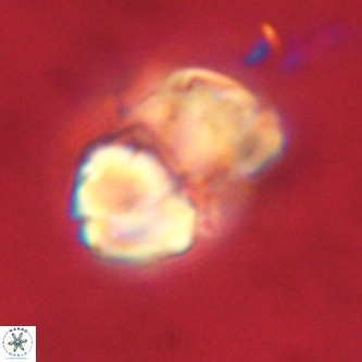 Micrantholithus imbricata VR 01242
