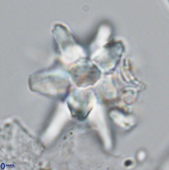 Micrascidites vulgaris VR 04145