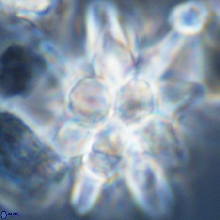 Micrascidites vulgaris VR 03354