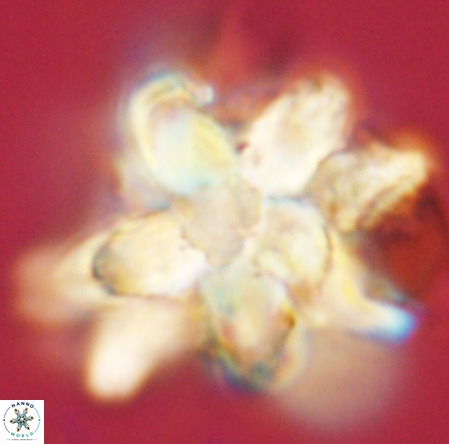 Micrascidites vulgaris VR 03381