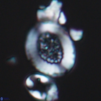 Miravetesina culverensis 10825