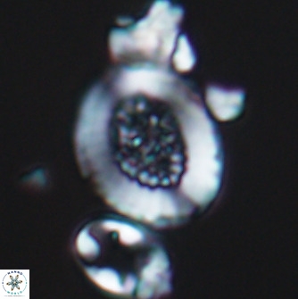 Miravetesina culverensis 10825
