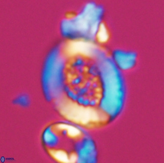 Miravetesina culverensis 10826