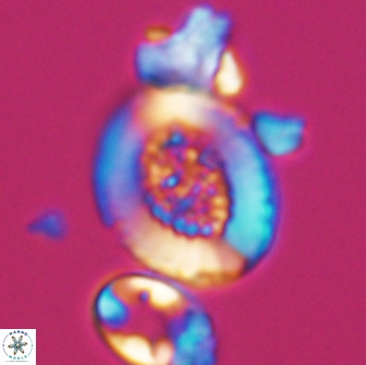 Miravetesina culverensis 10826