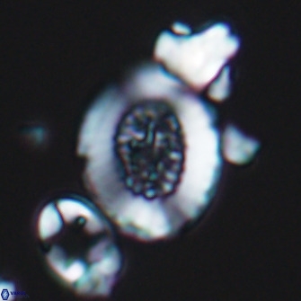 Miravetesina culverensis 10827