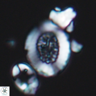 Miravetesina culverensis 10827