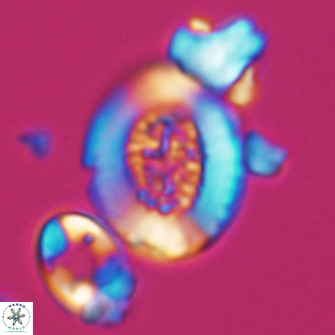 Miravetesina culverensis 10828