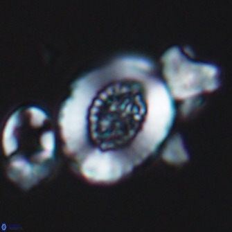 Miravetesina culverensis 10829