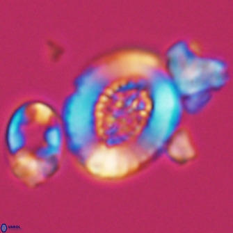 Miravetesina culverensis 10830