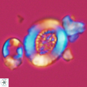 Miravetesina culverensis 10830
